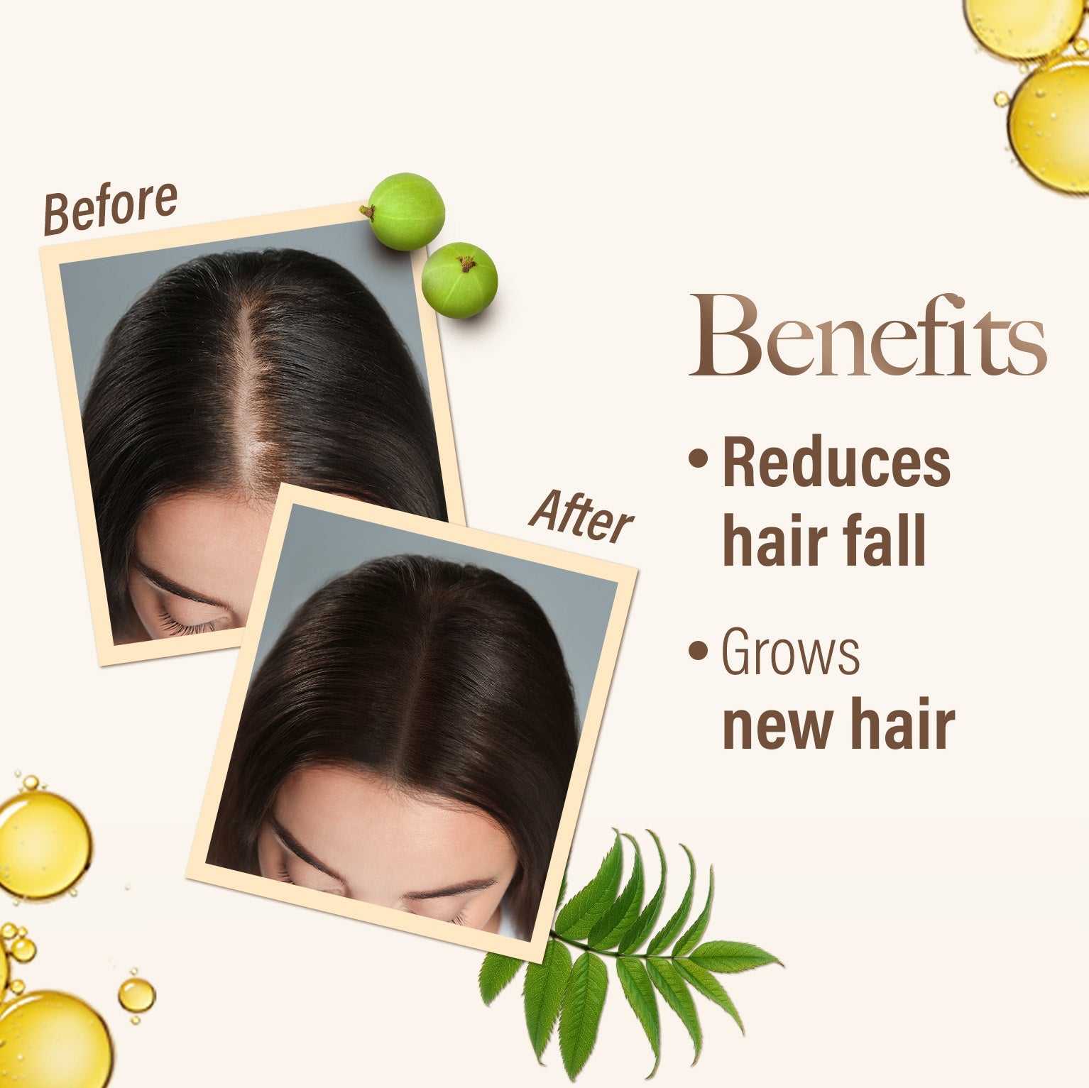 Kesh King Ayurvedic Medicinal Oil, reduces Hair fall, grows New Hair, 100ml